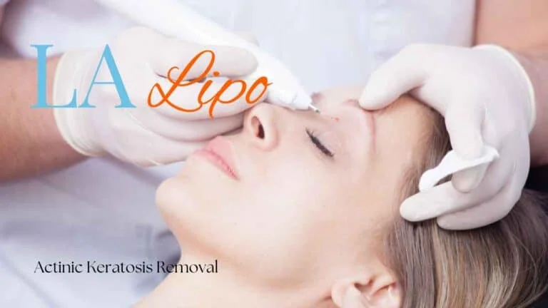 Woman receiving Actinic Keratosis Removal Treatment Watford