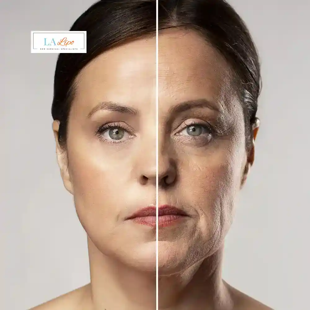 How Can You Tell If Non-Surgical Skin Tightening Is Right for You Watford?