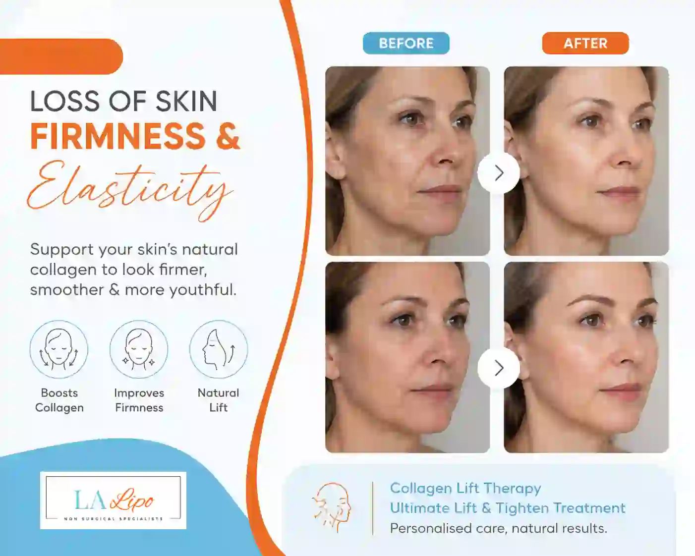 Sign #7: Loss of Skin Firmness and Elasticity Watford